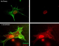 ECM Bioscience Myosin IIA Heavy Chain (Ser-1943), phospho-specific Rabbit