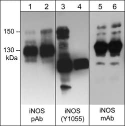ECM Bioscience iNOS Phospho-Regulation Antibody Sampler Kit, ECM Biosciences,