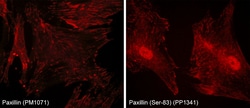ECM Bioscience Paxillin Phospho-Regulation Antibody Sampler Kit, ECM Biosciences,