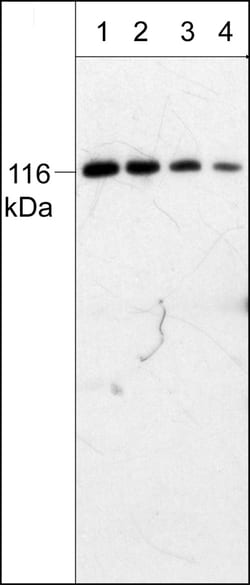 ECM Bioscience PYK2 (C-terminal region) Mouse Monoclonal Antibody, ECM