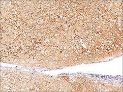 ECM Bioscience PKCα (Central region) Mouse Monoclonal Antibody, ECM Biosciences,