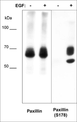 ECM Bioscience Paxillin (Ser-178), phospho-specific Rabbit Polyclonal Antibody,