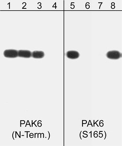 ECM Bioscience PAK6 (Ser-165), phospho-specific Rabbit Polyclonal Antibody,