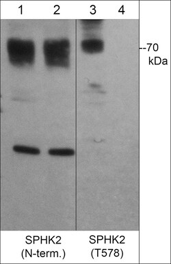 ECM Bioscience Sphingosine Kinase 2 Phospho-Regulation Antibody Sampler