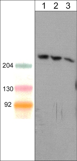 ECM Bioscience Shank1 (C-terminal region) Mouse Monoclonal Antibody, ECM