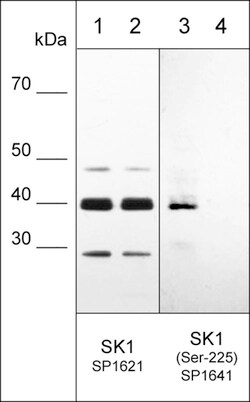 ECM Bioscience Sphingosine Kinase 1 (Ser-225), phospho-specific Rabbit