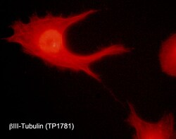 ECM Bioscience β-Tubulin (a.a. 168-177) Rabbit Polyclonal Antibody, ECM