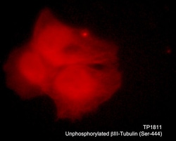 ECM Bioscience unphosphorylated βIII-Tubulin (Ser-444) Rabbit Polyclonal