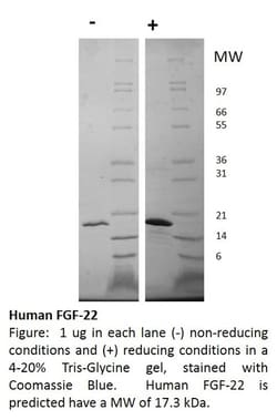 FUJIFILM IRVINE SCIENTIFIC INC Human FGF-22, Recombinant Protein, Shenandoah