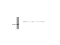 Detroit R POLYCLONAL ANTI-CYTOCHROME B5, Quantity: Each of 1