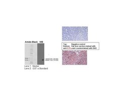 Detroit R WSTRN BLOT STRD 50UL GST ALPHA, Quantity: Each of 1