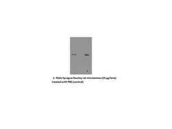 Detroit R 50UL EPOXIDE HYDROLASE, Quantity: Each of 1