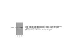 Detroit R POLYCLONAL RABBT ANTI-P450 2E1, Quantity: Each of 1