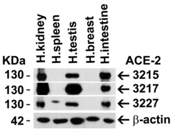 ProSci LLC ACE2 Antibody, Rabbit Polyclonal, Quantity: Each of 1