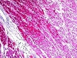 ProSci LLC CD63 Antibody [SPM524], Quantity: Each of 1