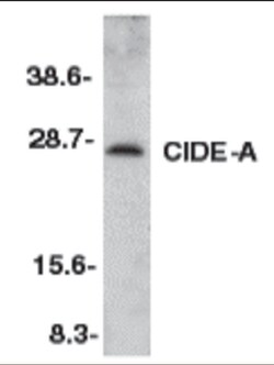 ProSci LLC CIDE-A Antibody, Rabbit Polyclonal, Quantity: Each of 1