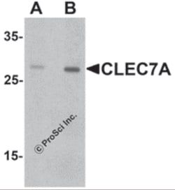ProSci LLC CLEC7A Antibody, Rabbit Polyclonal, Quantity: Each of 1