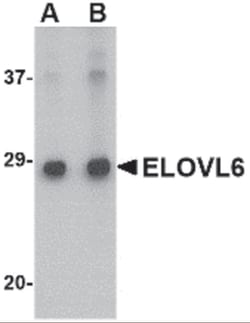 ProSci LLC ELOVL6 Antibody, Rabbit Polyclonal, Quantity: Each of 1