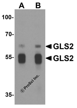 ProSci LLC GLS2 Antibody, Rabbit Polyclonal, Quantity: Each of 1