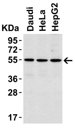 ProSci LLC IRAK-4 Antibody, Rabbit Polyclonal, Quantity: Each of 1