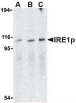 ProSci LLC IRE1p Antibody, Rabbit Polyclonal, Quantity: Each of 1