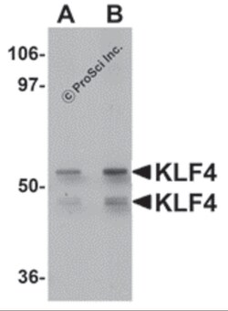 ProSci LLC KLF4 Antibody, Rabbit Polyclonal, Quantity: Each of 1