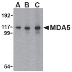 Pro Sci Inc MDA5 Antibody, Rabbit Polyclonal, Quantity: Each of 1