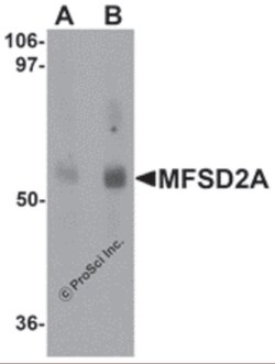 ProSci LLC MFSD2A Antibody, Rabbit Polyclonal, Quantity: Each of 1