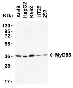 ProSci LLC MYD88 Antibody, Rabbit Polyclonal, Quantity: Each of 1