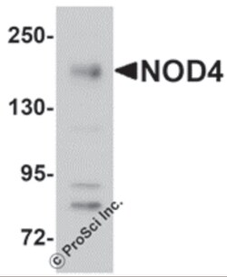 ProSci LLC NOD4 Antibody, Rabbit Polyclonal, Quantity: Each of 1