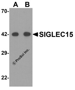 ProSci LLC SIGLEC15 Antibody, Rabbit Polyclonal, Quantity: Each of 1