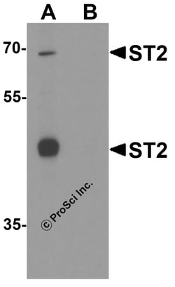 ProSci LLC ST2 Antibody, Rabbit Polyclonal, Quantity: Each of 1