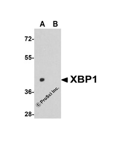 ProSci LLC XBP-1 Antibody, Rabbit Polyclonal, Quantity: Each of 1
