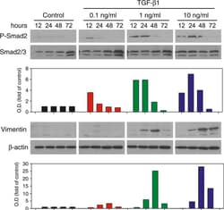 Supply Solutions Sigma - Monoclonal Anti-B-Actin Clone Ac-15, Quantity: