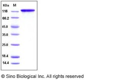 Sino Biological Human EGFR / HER1 / ErbB1 Protein (Fc Tag) 100ug, Quantity: