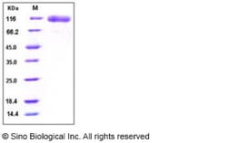 Sino Biological Recombinant Human EGFR Protein (ECD, His Tag), HPLC-verified,