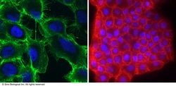 Sino Biological EGFR / HER1 / ErbB1 Antibody (FITC), Mouse MAb 25Tests,