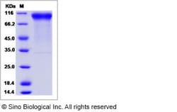 Sino Biological Recombinant Human Her2/ERBB2 Protein (ECD), Biotinylated,
