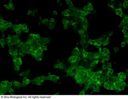 Sino Biological HER2 / ErbB2 / CD340 Antibody, Mouse MAb 100uL, Quantity: