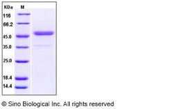 Sino Biological Human CD112 / Nectin-2 / PVRL2 Protein 100ug, Quantity: