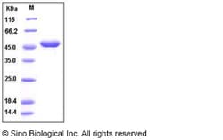 Sino Biological Human G-CSF / CSF3 Protein (Fc Tag) 100ug, Quantity: Each