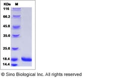 Sino Biological Human G-CSF / CSF3 Protein (Isoform b) 100ug, Quantity: