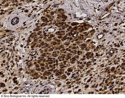 Sino Biological Recombinant Anti-basic FGF/FGF2 Antibody, Rabbit Monoclonal,