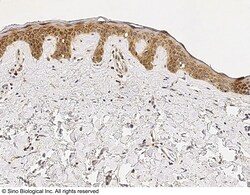 Sino Biological IL-1RA / IL1RN Antibody, Rabbit MAb 100uL, Quantity: Each