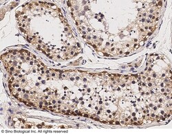Sino Biological Recombinant Anti-SOX2 Antibody, Rabbit Monoclonal, Quantity: