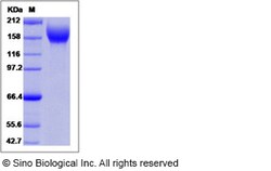 Sino Biological Human VEGFR2 / Flk-1 / CD309 / KDR Protein (Domain 1&2&3,