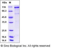 Sino Biological Human VEGFR2 / Flk-1 / CD309 / KDR Protein (His & GST Tag)