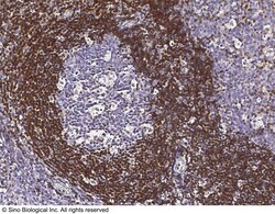 Sino Biological Bcl-2 Antibody (FITC), Rabbit MAb 100Tests, Quantity: Each