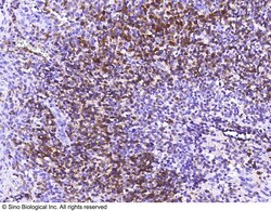 Sino Biological CD79A / Ig-alpha Antibody, Rabbit MAb 100uL, Quantity: