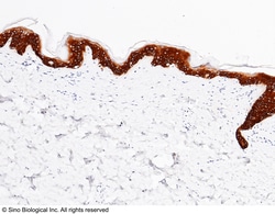 Sino Biological Anti-Cytokeratin 14/KRT14 Antibody, Rabbit Polyclonal,